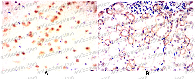 Валидация AntibodySystem RHF02504 (2423)