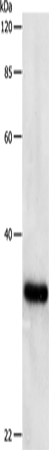 Вестерн-блоттинг, PCNA, клетки HeLa