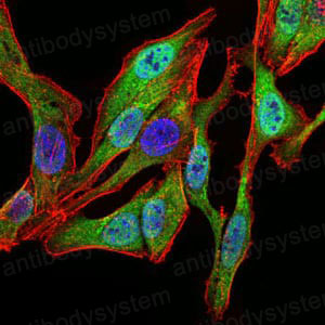 Валидация IF - AntibodySystem RHF90101