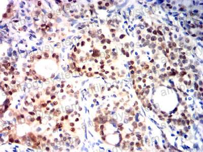 Валидация AntibodySystem RHF98202 (2762)