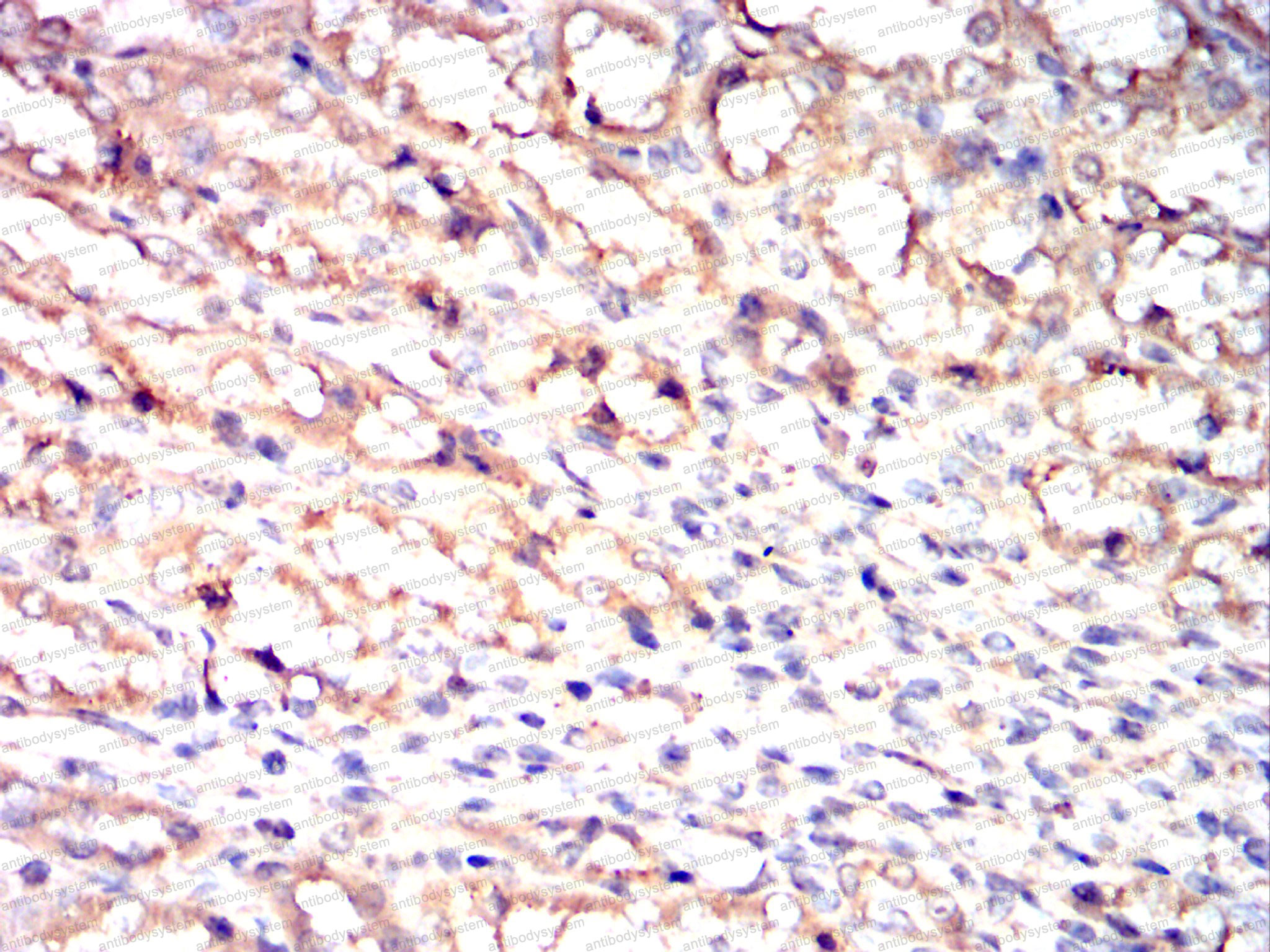 Валидация AntibodySystem RHK91801 (3746)