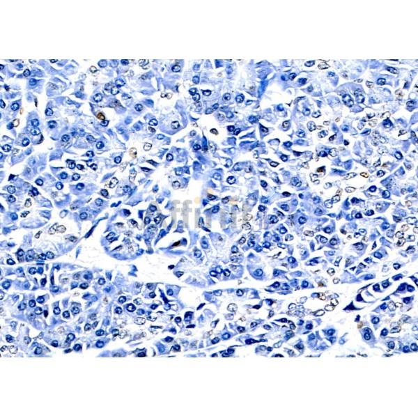 Валидация Affinity BF0722 - 5394