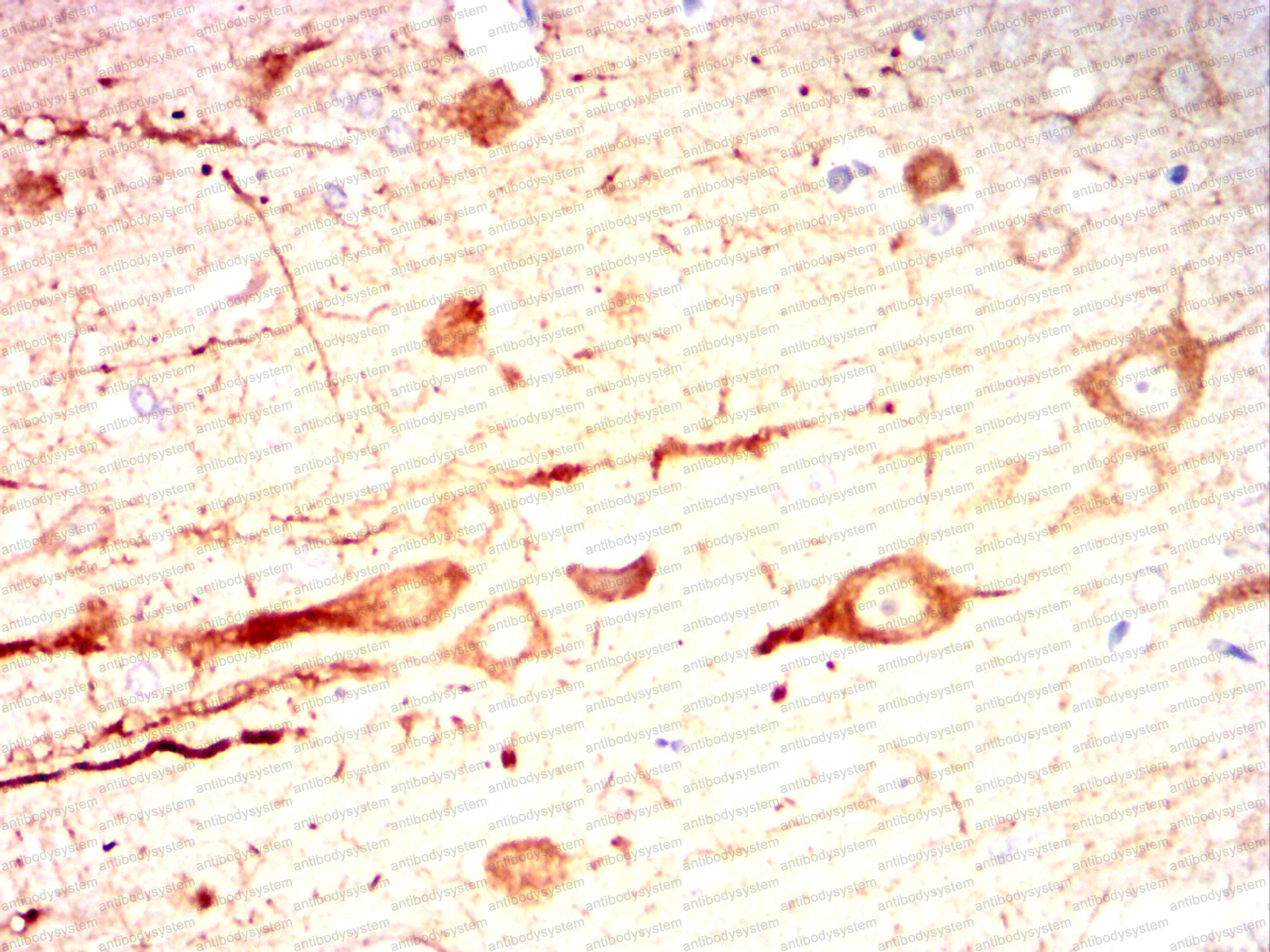 Валидация AntibodySystem RHG72104 (3066)