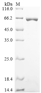 SDS-PAGE