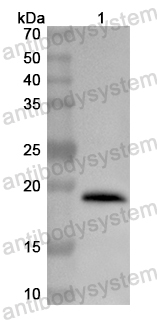 Валидация AntibodySystem PHB63101