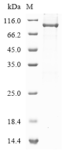 SDS-PAGE