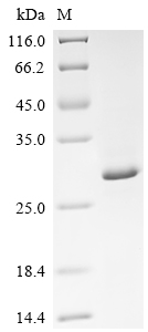 SDS-PAGE