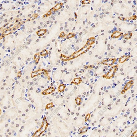 Иммуногистохимия, Mineralocorticoid receptor, ткань почки мыши