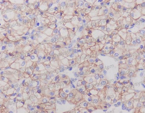 Валидация AntibodySystem RHH37201