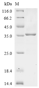 SDS-PAGE