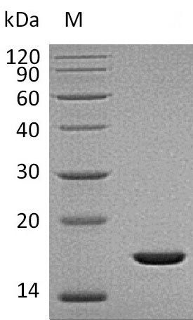 SDS-PAGE