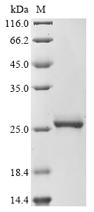 SDS-PAGE