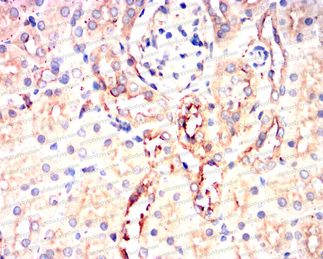 Валидация AntibodySystem RHE35201 (2102)