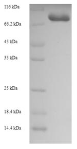 SDS-PAGE