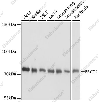 Вестерн-блоттинг, ERCC2, различные клеточные линии