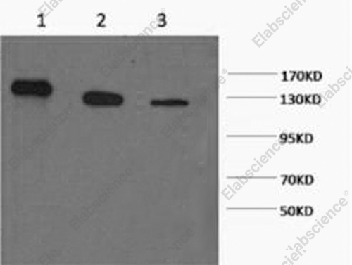 Вестерн-блоттинг, PARP1, клетки HeLa, 293T и Jurkat