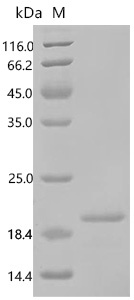 SDS-PAGE