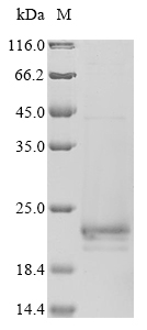 SDS-PAGE