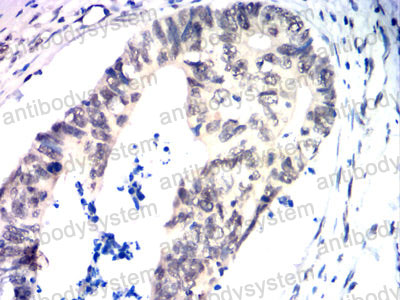 Валидация AntibodySystem RHG42207