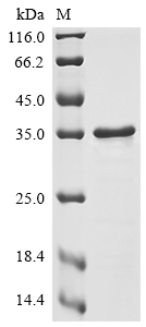 SDS-PAGE