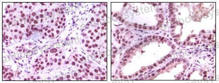 Валидация AntibodySystem RHA88906