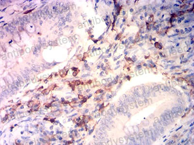 Валидация AntibodySystem RHC33701