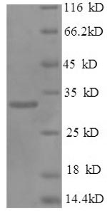 SDS-PAGE