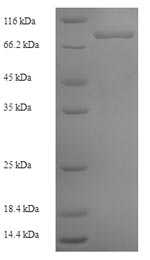 SDS-PAGE