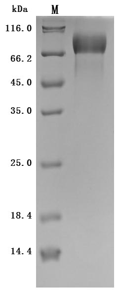 SDS-PAGE