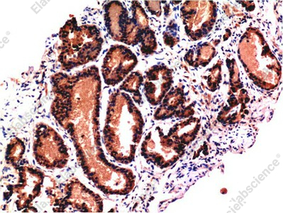 Иммуногистохимия, CASP3, ткань предстательной железы человека