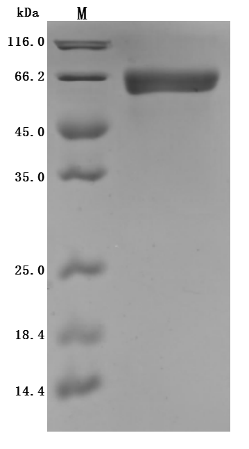 SDS-PAGE
