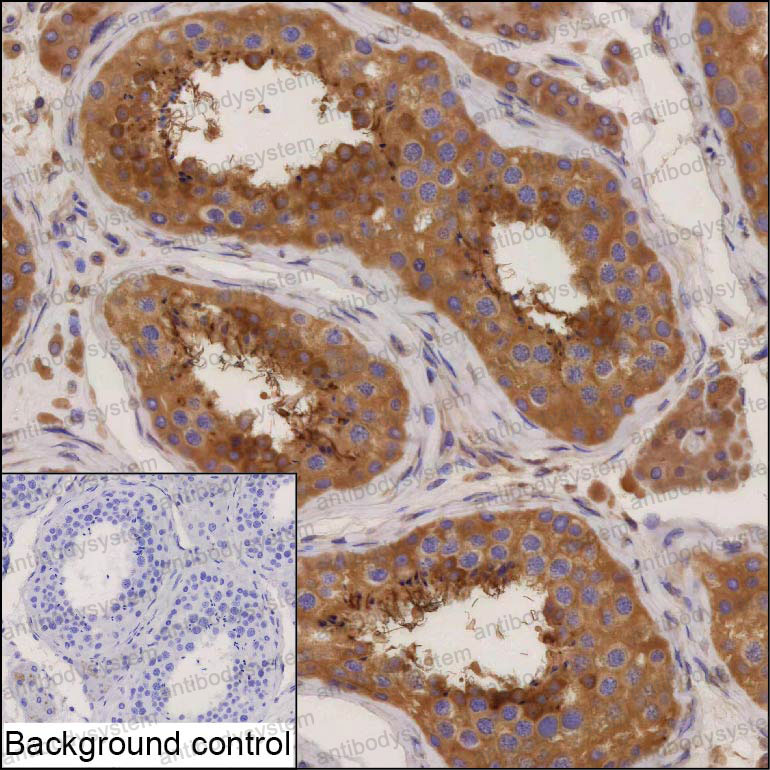 Валидация AntibodySystem RHC82603