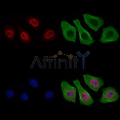 Валидация Affinity AF6178 - 3399