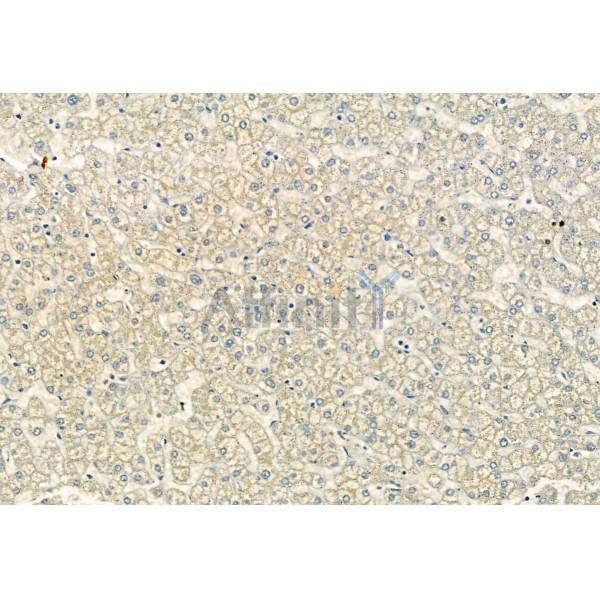 Валидация Affinity DF6118 - 17338