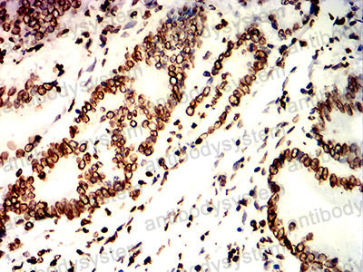 Валидация AntibodySystem RHD40903 (1575)