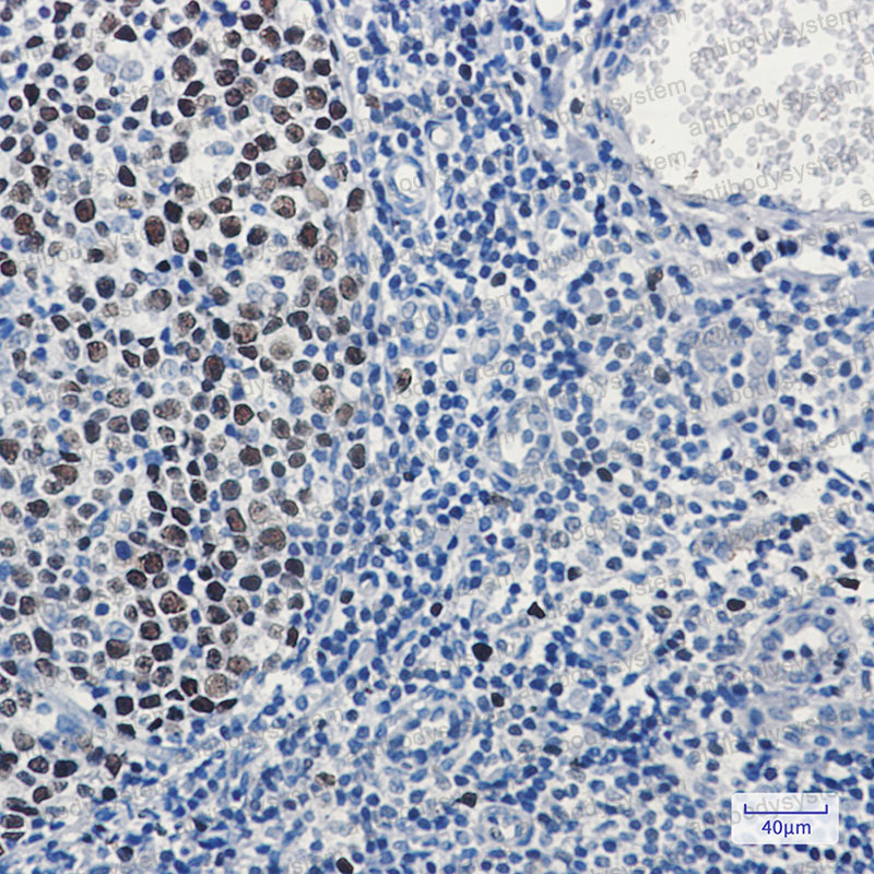 Валидация AntibodySystem RHD66501