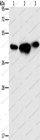 Вестерн-блоттинг, ARFGAP1, клетки 293T, PC3 и NIH/3T3