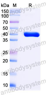 Валидация SDS-PAGE - AntibodySystem RMD36901