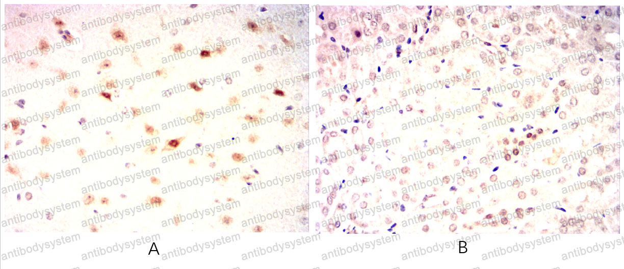 Валидация AntibodySystem RHK50101 (3686)