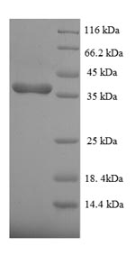 SDS-PAGE