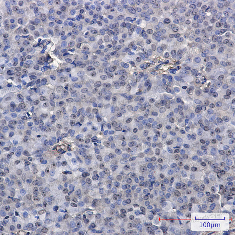 Валидация AntibodySystem RHN89301