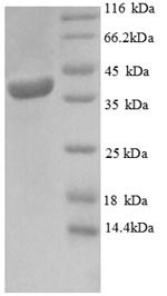 SDS-PAGE