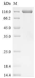 SDS-PAGE