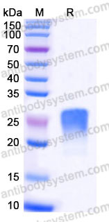 EHB91606, SDS-PAGE