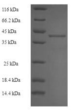 SDS-PAGE
