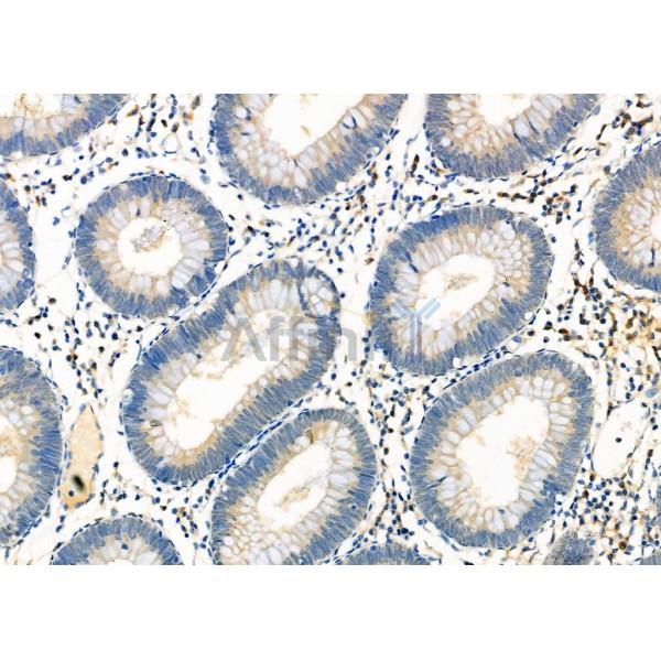 Валидация Affinity DF12387 - 6861