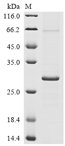 SDS-PAGE