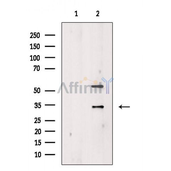 Валидация Affinity DF2377 - 12962