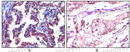 Валидация AntibodySystem RHN90601