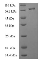 SDS-PAGE